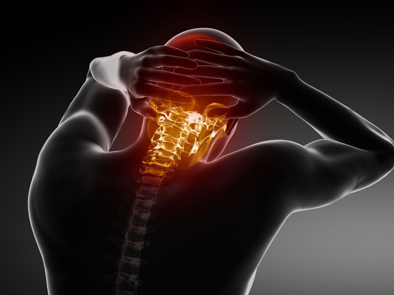 Dolor de cabeza por cervicales